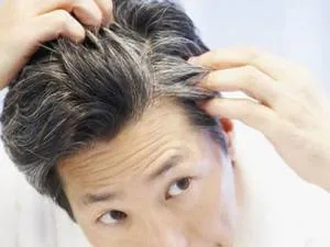 جلوگیری از ریزش مو