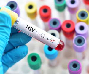 واکسن ایدز HIV