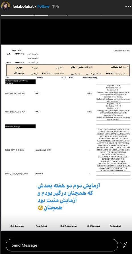 آزمایش لیلا بلوکات