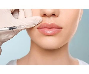 تزریق ژل و بوتاکس