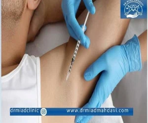 بوتاکس زیر بغل، معجزه کاهش تعریق