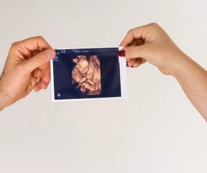 رادیولوژی در بارداری