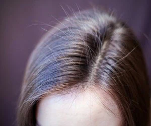 باورهای غلط مو