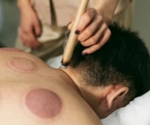  چه کسانی نباید در فصل بهار حجامت کنند؟ 