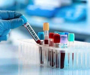راهنمای جامع خدمات پزشکی و درمانی در تهران: از آزمایشگاهها تا کلینیکهای تخصصی