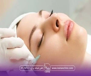پروفایلو استراکچرا
