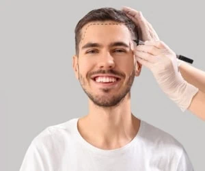 کلینیک‌های کاشت مو
