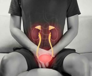 داروی گیاهی برای دفع سنگ مثانه