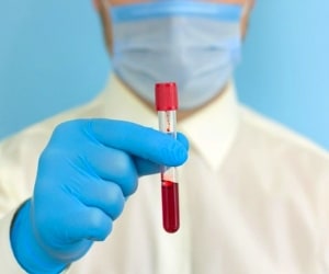 بالا بودن گلبول سفید