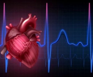 پیشگیری از سکته با فولیک اسید