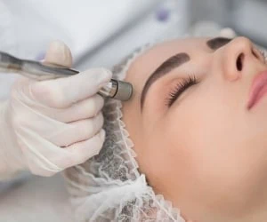 میکرودرم ابریژن