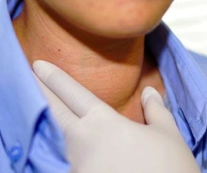 نشانه گواتر