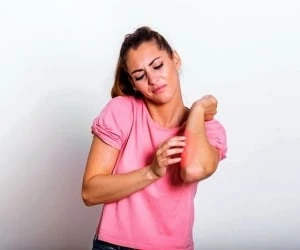 کهیر بعد زایمان