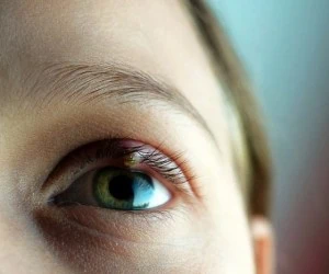 حساسیت چشم به نور