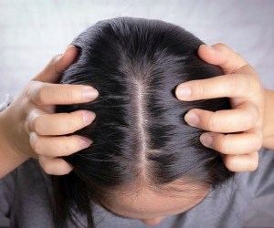 دلیل ریزش مو و درمان آن