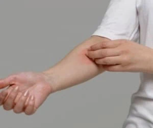 دلیل خارش پوست