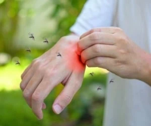 بیماری مورژلونز