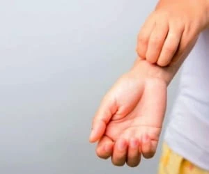 خارش بدن