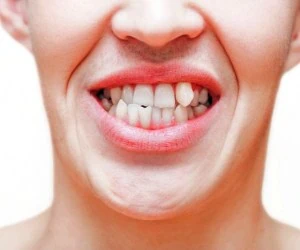 اوربایت