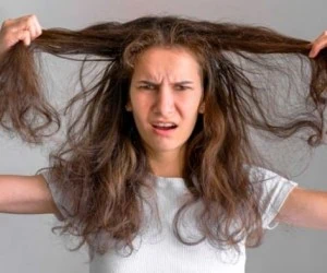 کچلی و ریزش مو