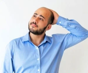 درمان گیاهی و دارویی ریزش مو مردان