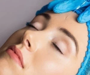 بوتاکس در بارداری