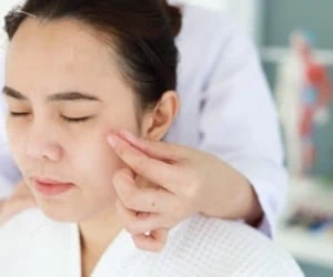 طب سوزنی صورت
