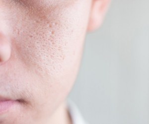 منافذ باز پوست