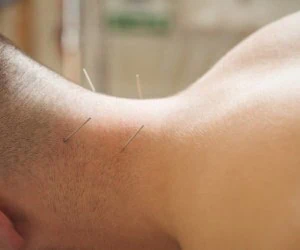 طب سوزنی دیابتی