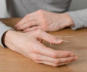 طب سوزنی