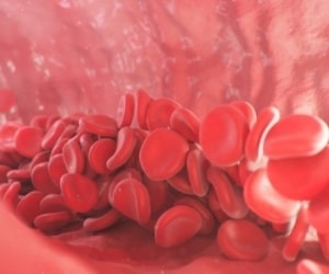 افزایش پلاکت خون با این مواد غذایی