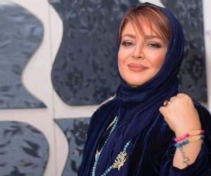 جراحی زیبایی بازیگران ایرانی