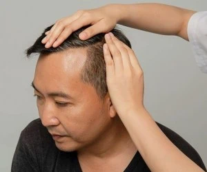  بعد کندن موی سفید، چه اتفاقی برات می افته 