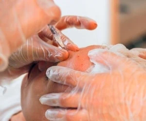 مزوبوتاکس چیست