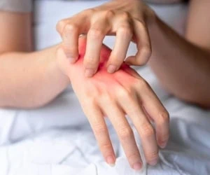 کلستاز بارداری