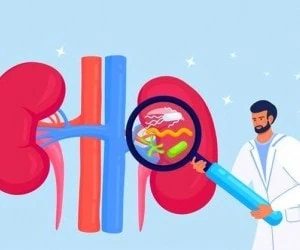 پاکسازی کلیه