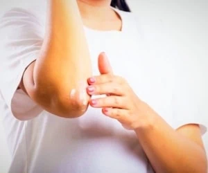 رفع سیاهی آرنج و زانو