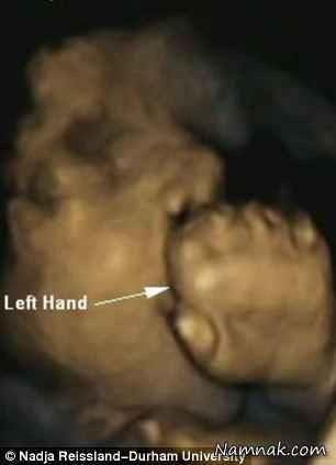 جنین در حال خوردن دست