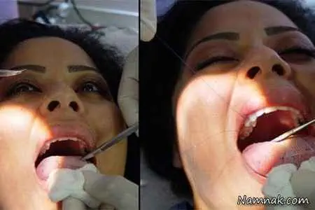 زجرآور ترین رژیم لاغری دنیا + عکس