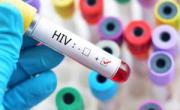 واکسن ایدز HIV