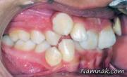 ناهنجاری دندان