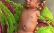 نوزاد بدون دست