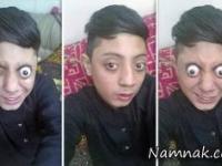 درآوردن چشم