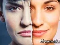 اختلال مانیا