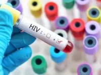 واکسن ایدز HIV