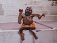 خمیدگی استخوان