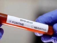 کرونا مثبت