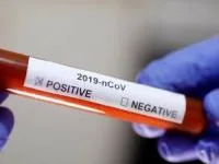 کرونا مثبت