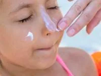 آفتاب سوختگی