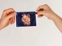 رادیولوژی در بارداری